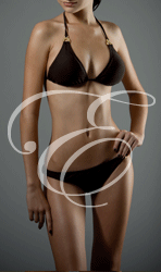 Cara | London Escort